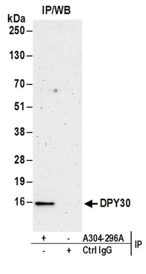 Dpy30 Polyclonal Antibody A304 296a T