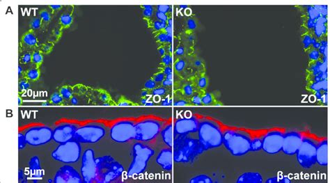 Adherens And Tight Junctions In The Ependyma Of Wt And T Cat Ko Mice