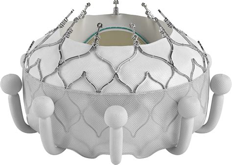 The Evoque Transcatheter Mitral Valve Edwards Lifesciences Llc