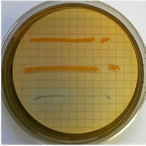 Nutrient Medium Lactose Ttc Tergitol Agar A Matrix Ng