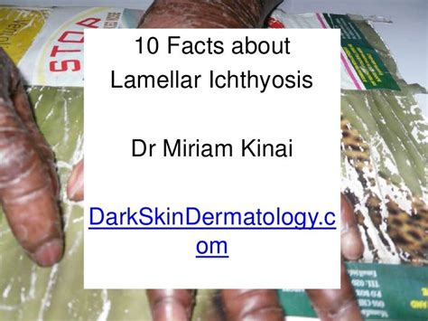 Lamellar ichthyosis