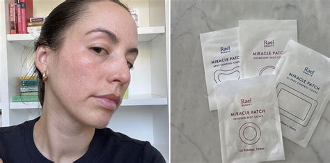 Rael Ultimate Pimple Patch Kit Review With Photos Popsugar Beauty