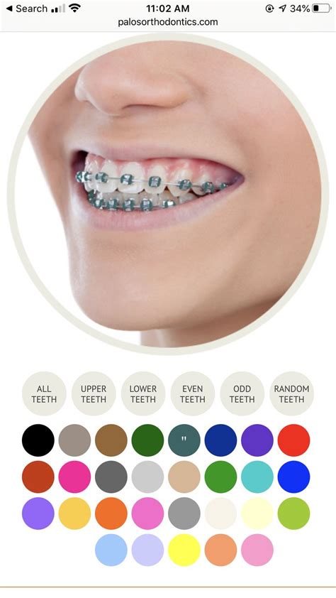 Teal Brace Rubber Bands Braces Tips Braces Rubber Bands Braces Colors