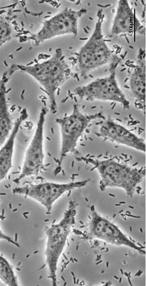 Bacterial Contamination Cell Culture