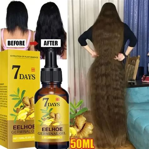 Leo De Crescimento De Cabelo Para Homens E Mulheres Crescimento R Pido