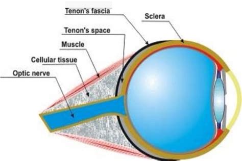 Cápsula de Tenon En Ojopedia