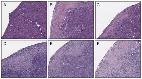 Histologic Liver Damage In Tgfb1 −− Mice Is Independent Of Cd1dinkt