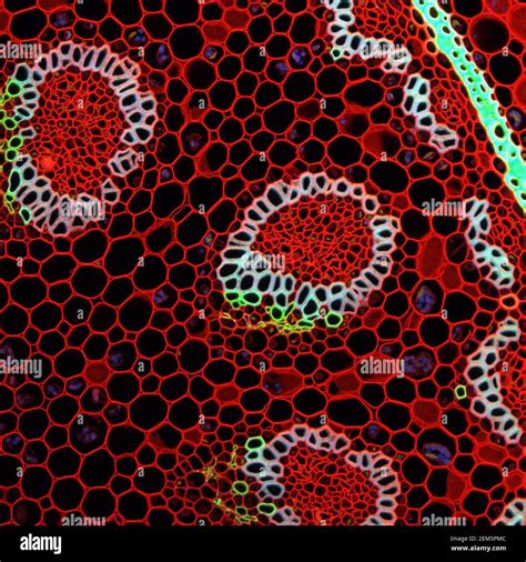 Muestra microscópica de planta de Convallaria, señal de fluorescencia ...