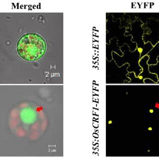 Subcellular Localization Of The OsCRF1 EYFP Fusion Protein A 35S