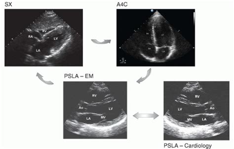 Echocardiography Radiology Key