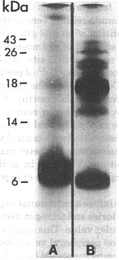 Typical Sds Polyacrylamide Gel Electrophoresis Pattern Of Extracted