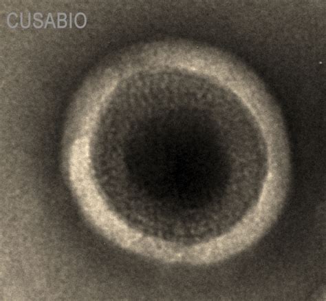 Recombinant Human B lymphocyte antigen CD20 MS4A1 VLPs Active 其他 武汉华美生物