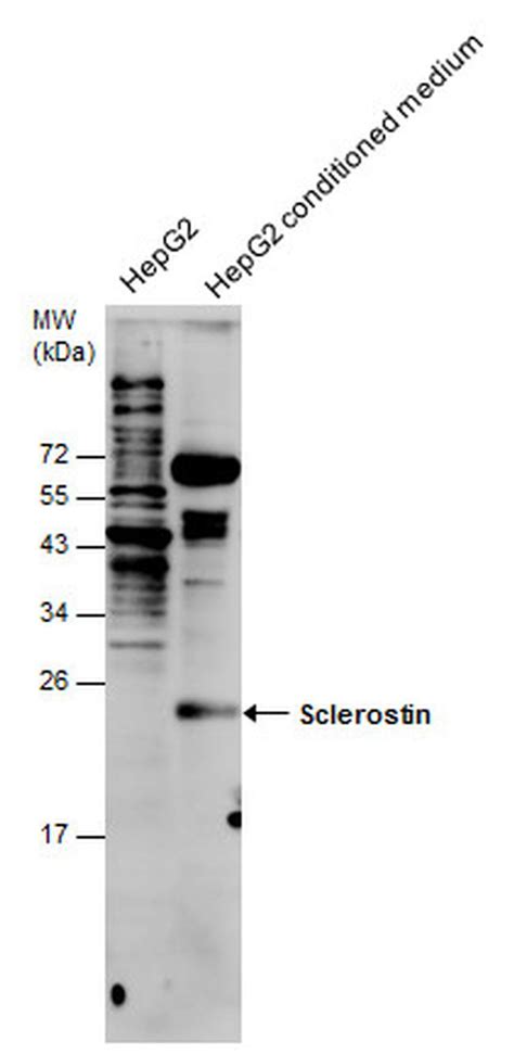 Sclerostin Polyclonal Antibody (PA5-85681)