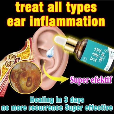 Chronic Otitis Ear Drops Tinnitus Ear Ear Wax Removal Healthy Care Ear