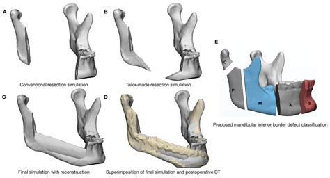 Applied Sciences Free Full Text Computer Assisted Preoperative