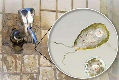 Ameba Mangia Cervello Nell Acqua Del Rubinetto C Una Vittima