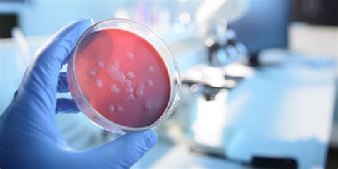 Microbiological Culture Eurofins Environment Testing Pty Ltd