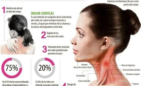 Torticolis Congenita Que Es Causas Sintomas Tratamiento Y Consejos