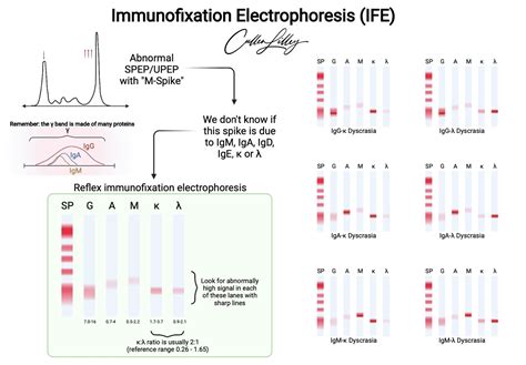 Serum Protein Electrophoresis And Immunofixation Electrophoresis SPEP