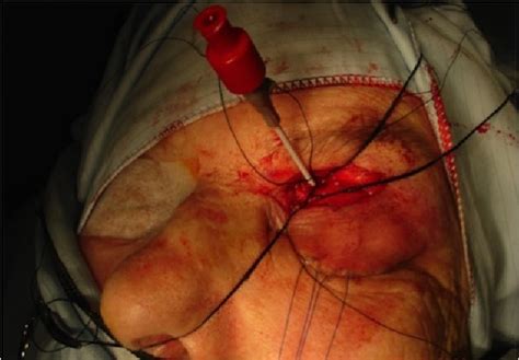 Figure 1 From Clinical Interventions In Aging Dovepress Difficult