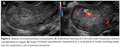 Radiologia Brasileira First Trimester Pregnancy Abnormalities