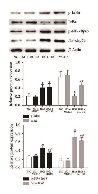 High Glucose Induces The Activation Of Nf B Signaling And Release Of