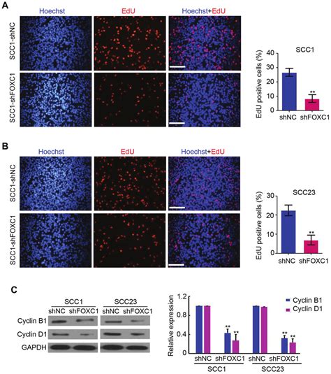 Knockdown Of Foxc1 Inhibits Oscc Cell Proliferation A And B Edu