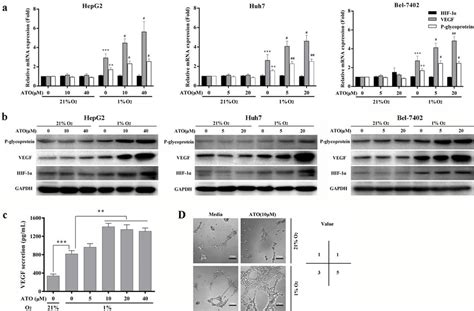 Hypoxic HCC cells after ATO treatment upregulate expression of HIF 1α