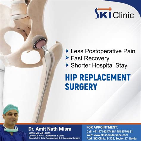 Revitalize Your Hip Joint with Total Hip Replacement Surgery | by Dr ...