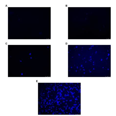 CM H2DCFDA Staining Results Of Huh 7 Cells After 200 Ppb O 3 Exposure