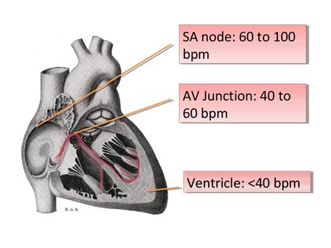 ECG Lecture: Sinus arrest, sinoatrial exit block, AV block and escape…