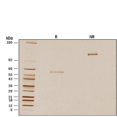 Recombinant Human Noggin GMP Protein CF 6057 GMP 025 R D Systems