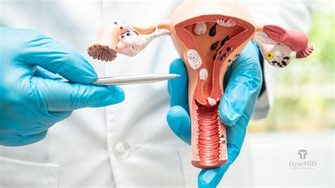 Atrofia Vaginal Síndrome Genitourinario en la Menopausia