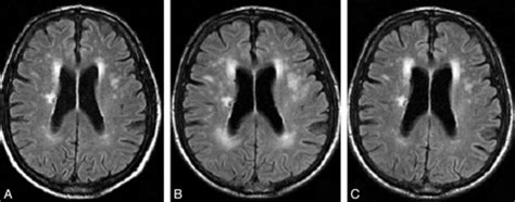 Stroke Medicine for Stroke Physicians and Neurologists