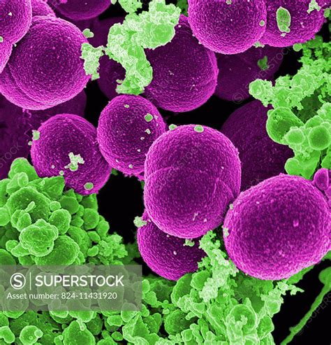 Scanning electron micrograph of S. aureus bacteria escaping destruction ...