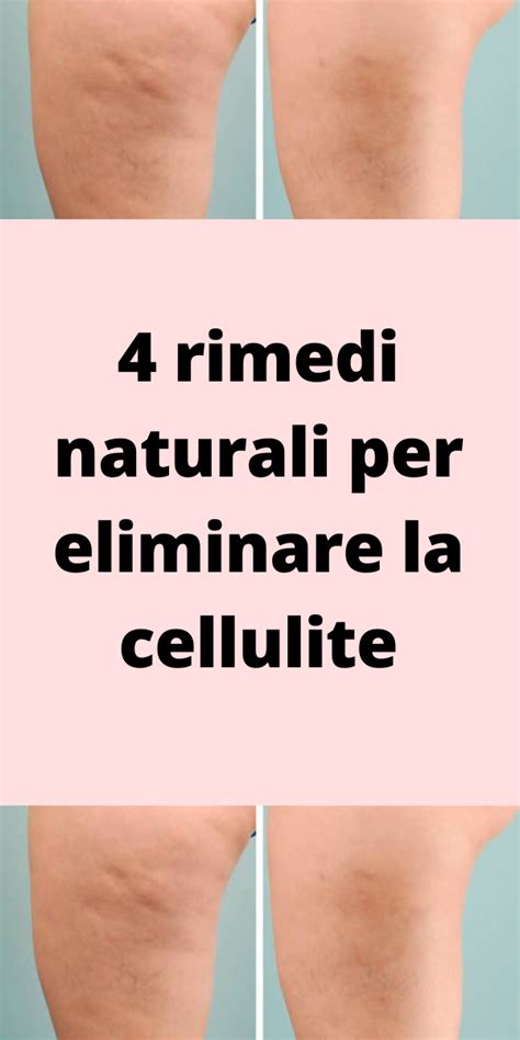 Rimedi Naturali Per Eliminare La Cellulite Artofit