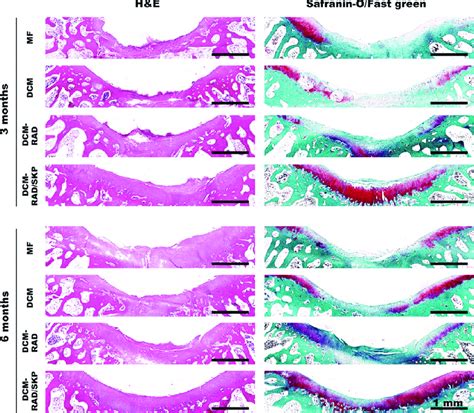 Histological Evaluation Of Repaired Tissue Representative Hematoxylin