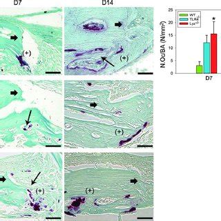 Enhanced Osteoclastogenesis In Tlr And Lyz Tlr Mice Left