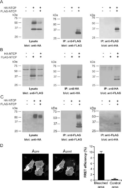 [pdf] Homo And Hetero Dimeric Architecture Of The Human Liver Na⁺ Dependent Taurocholate Co