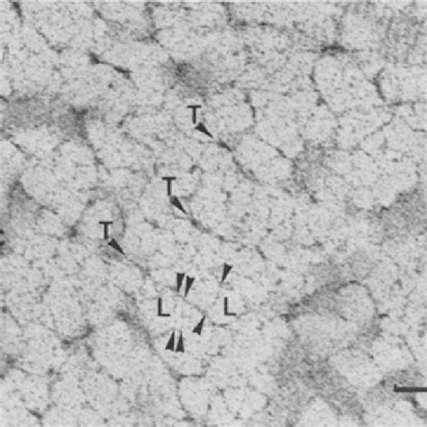 High Power Electron Micrograph Of Cartilage Interterritorial Matrix