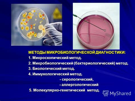 Презентация на тему: "МИКРОБИОЛОГИЯ С ОСНОВАМИ ЭПИДЕМИОЛОГИИ И МЕТОДАМИ ...
