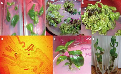 Figure 1 From High Frequency Plantlet Regeneration Via Direct