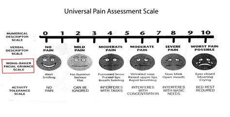 Wong Baker Facial Grimace Scale