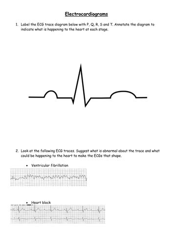 Ekg Practice Worksheets With Answers