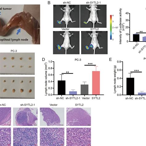 SYTL2 Facilitates Lymph Node Metastasis Of PCa Cells In Vivo A