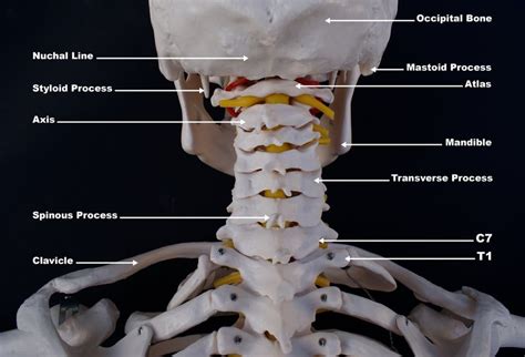 Chronic Neck Pain: Common Causes and Reasons