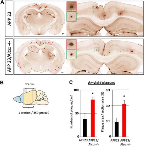 Quantification Of Amyloid Plaques In App Mouse Brain In The Presence