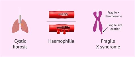 Examples of monogenic diseases