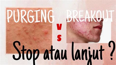 PERBEDAAN PURGING DAN BREAKOUT STOP ATAU LANJUT YouTube