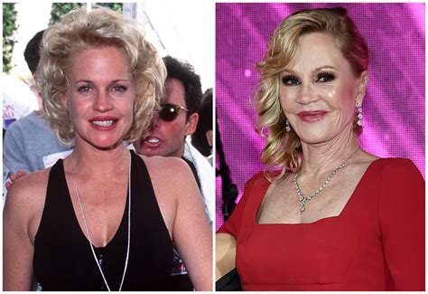 Melanie Griffith Plastic